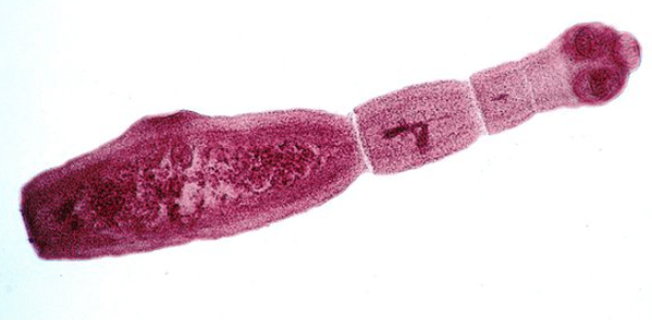 Echinococus